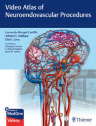 Video Atlas of Neuroendovascular Procedures - Leonardo Rangel-Castilla, Adnan Siddiqui, Giuseppe Lanzino, Jason Davies, Kenneth Snyder, L. Nelson Hopkins, Elad Levy (ISBN: 9781684201181)