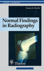 Normal Findings in Radiography - Torsten B. Moller (ISBN: 9783131165312)