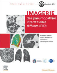 Imagerie Des Pneumopathies Interstitielles Diffuses (ISBN: 9782294781902)