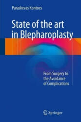 State of the art in Blepharoplasty - Paraskevas Kontoes (ISBN: 9783319526416)