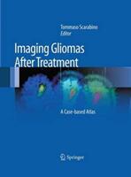 Imaging Gliomas After Treatment: A Case-Based Atlas (ISBN: 9788847058262)