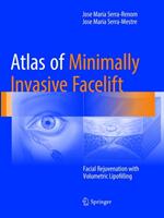 Atlas of Minimally Invasive Facelift: Facial Rejuvenation with Volumetric Lipofilling (ISBN: 9783319814230)