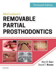 McCracken's Removable Partial Prosthodontics - Alan B Carr, David T Brown (ISBN: 9780323339902)