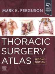 Thoracic Surgery Atlas - Mark K. Ferguson (ISBN: 9780323930222)