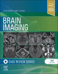 Brain Imaging - Laurie Loevner (ISBN: 9781455774852)