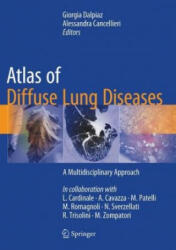 Atlas of Diffuse Lung Diseases - Giorgia Dalpiaz, Alessandra Cancellieri (ISBN: 9783319427508)