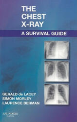 Chest X-Ray: A Survival Guide - Gerald De Lacey (2008)