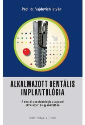Alkalmazott dentális implantológia (ISBN: 9789633315972)