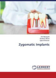 Zygomatic Implants - Shailesh Menat, Ujjaval Bhavsar (ISBN: 9786204984766)