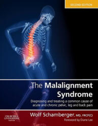Malalignment Syndrome - Wolf Schamberger (ISBN: 9780443069291)