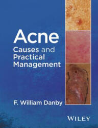 Acne - Causes and Practical Management - F William Danby (ISBN: 9781118232774)