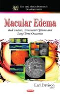 Macular Edema - Risk Factors Treatment Options and Long-Term Outcomes (ISBN: 9781633215849)