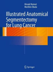 Illustrated Anatomical Segmentectomy for Lung Cancer - Hiroaki Nomori, Morihito Okada (2012)