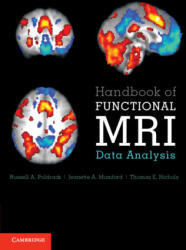 Handbook of Functional MRI Data Analysis - Russell A. Poldrack, Jeanette A. Mumford, Thomas E. Nichols (ISBN: 9781009481168)