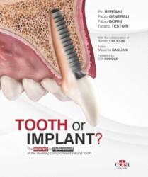 Tooth or Implant? The recovery or replacement of the severely compormised natural tooth - Pio Bertani, Paolo Generali, Fabio Gorni, Tiziano Testori (2024)