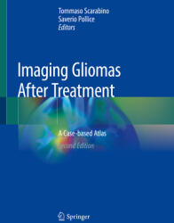 Imaging Gliomas After Treatment: A Case-Based Atlas (ISBN: 9783030312121)