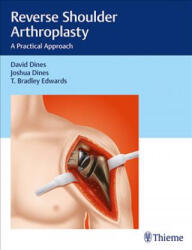 Reverse Shoulder Arthroplasty - David M. Dines, Joshua Dines, T Bradley Edwards (ISBN: 9781626233607)
