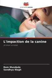 L'impaction de la canine (ISBN: 9786207964352)