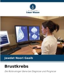 Brustkrebs (ISBN: 9786208076559)