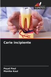 Carie incipiente (ISBN: 9786207755066)