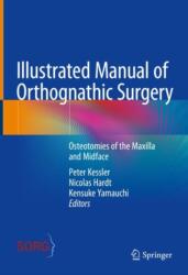 Illustrated Manual of Orthognathic Surgery (ISBN: 9783031498688)
