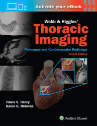 Webb & Higgins Thoracic Imaging: Print + eBook with Multimedia - Travis Henry (ISBN: 9781975199388)