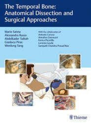 Temporal Bone - Mario Sanna, Alessandra Russo, Abdelkader Taibah, Gianluca Piras, Wenlong Tang (ISBN: 9783132419346)