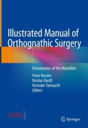 Manual ilustrat de chirurgie ortognatică (ISBN: 9783031069772)