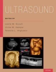 Ultrasound - Leslie M. Scoutt (ISBN: 9780199988105)