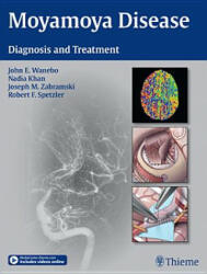 Moyamoya Disease - John E. Wanebo, Joseph M. Zabramski, Robert F. Spetzler (2013)