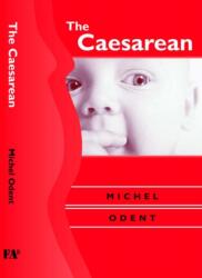 Cezariană (ISBN: 9781853437182)