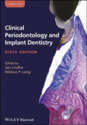 Clinical Periodontology and Implant Dentistry, 2 Volume Set - Niklaus P. Lang, Jan Lindhe (ISBN: 9780470672488)