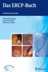 Das ERCP-Buch, m. DVD-ROM - Michael Keymling, Bernd M. Kohler, Heinrich J. Lübke (ISBN: 9783131493019)