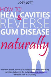 How to Heal Cavities and Reverse Gum Disease Naturally: a science-based, proven plan to heal teeth and gums using nutrition, balancing the metabolism, - Joey Lott (ISBN: 9781542565684)
