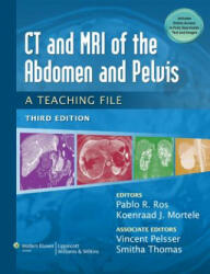 CT & MRI of the Abdomen and Pelvis - Pablo R Ros (2014)
