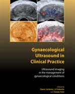 Gynaecological Ultrasound in Clinical Practice: Ultrasound Imaging in the Management of Gynaecological Conditions (2009)