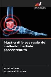 Piastra di bloccaggio del malleolo mediale precontenuta (ISBN: 9786208551940)