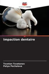 Impaction dentaire (ISBN: 9786208510060)
