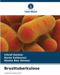 Brusttuberkulose (ISBN: 9786208205843)