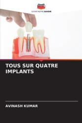 Tous Sur Quatre Implants (ISBN: 9786208300456)
