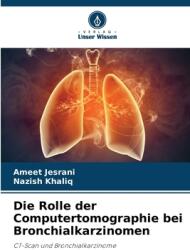 Die Rolle der Computertomographie bei Bronchialkarzinomen (ISBN: 9786208188900)