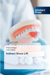 Indirect Sinus Lift (ISBN: 9786206775300)