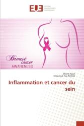 Inflammation et cancer du sein (ISBN: 9786139519880)