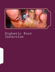 Diabetic Foot Infection - Dr Romana Ayub, MR Syed Shahmeer Raza (ISBN: 9781519448781)