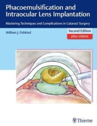 Phacoemulsification and Intraocular Lens Implantation (2017)