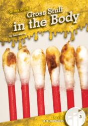 Gross Stuff in the Body (ISBN: 9781098288655)