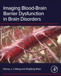 Imaging Blood-Brain Barrier Dysfunction in Brain Disorders (ISBN: 9780443329746)