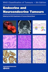 Endocrine and Neuroendocrine Tumours - WHO Classification of Tumours Editorial Board (ISBN: 9789283245247)