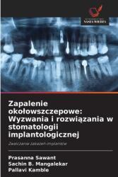 Zapalenie okolowszczepowe: Wyzwania i rozwi amp; #261; zania w stomatologii implantologicznej (ISBN: 9786208611590)
