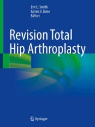 Revision Total Hip Arthroplasty (ISBN: 9783031839580)